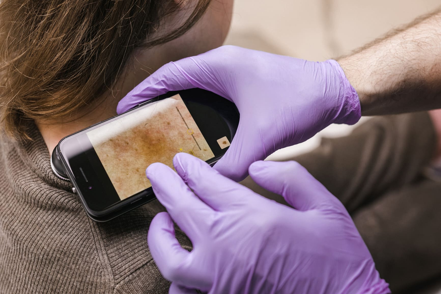 A woman is having her cell phone examined by a doctor as part of a melanoma clinical trial.