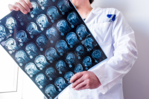 Explaining Central Nervous System (CNS) Protocols & Drug Development